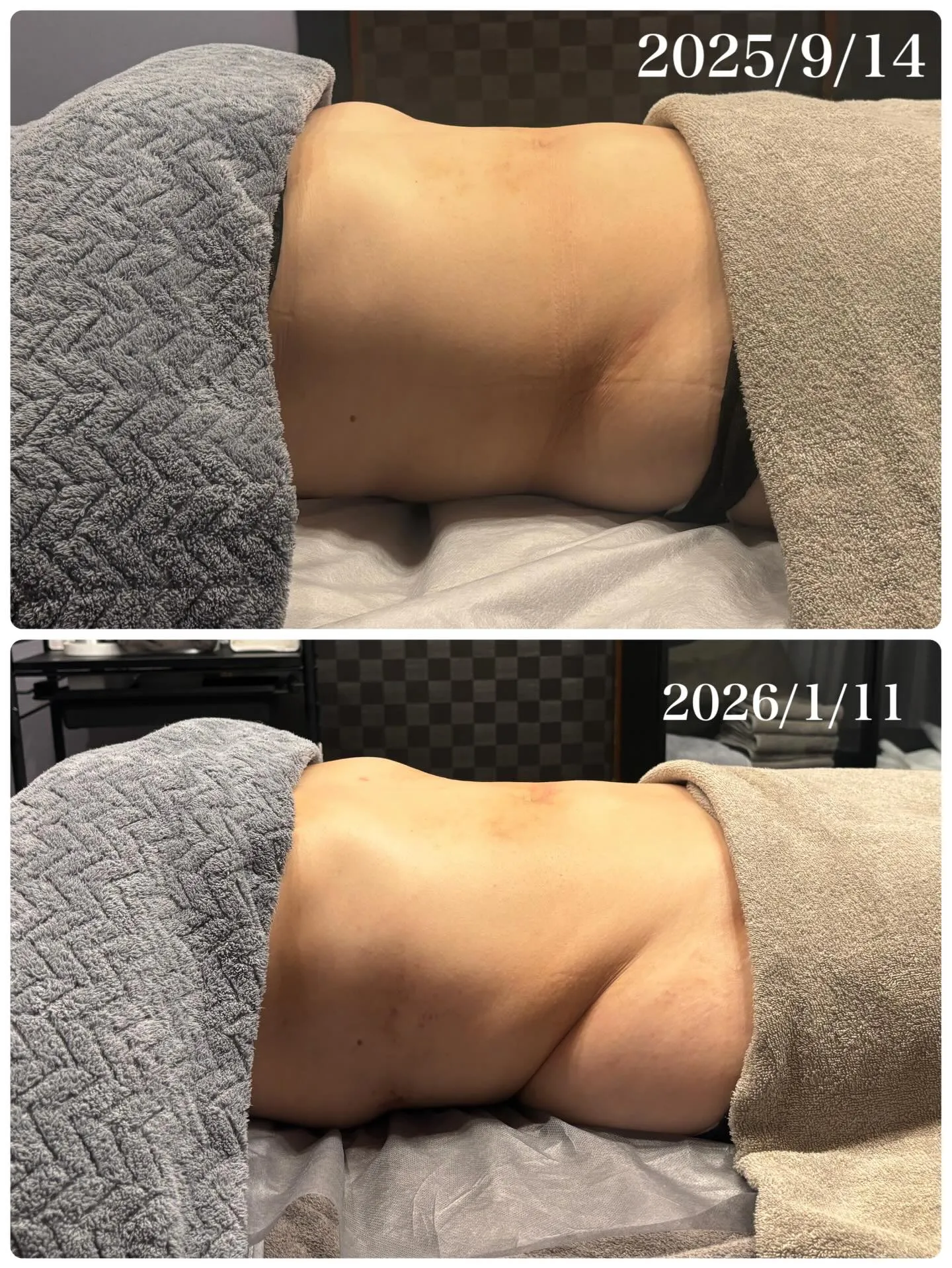 ✴︎JR川崎駅ラゾーナそばの腸もみサロン♡