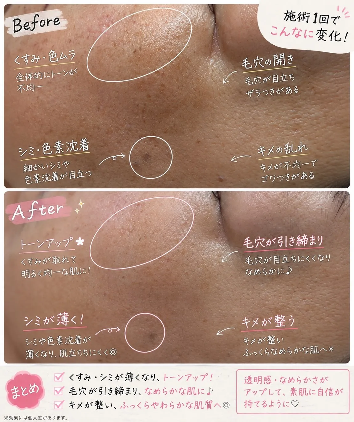 #川崎駅近くのエステサロン